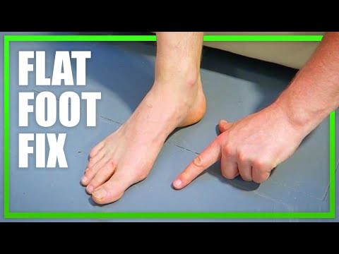 Short Foot Exercise for Flat Feet [Ep48]